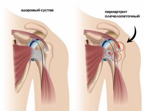 Картинка Массажисты Урала, ассоциация по обучению